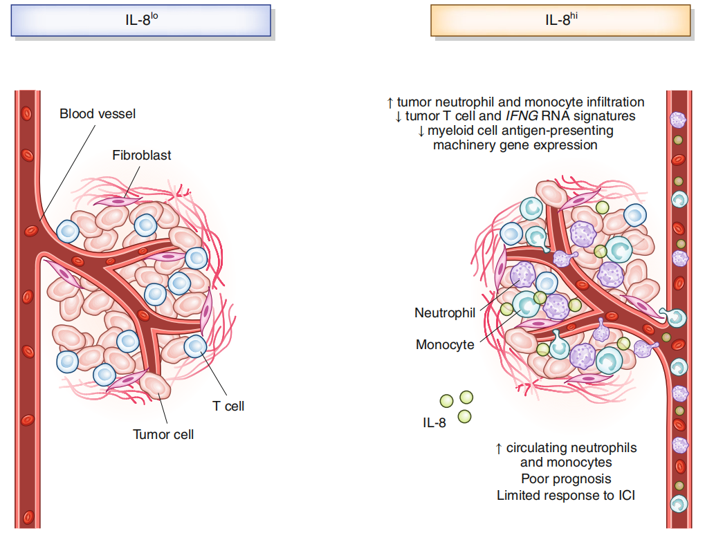 Tumor microenvironment regulator IL-8 Tumor microenvironment regulator IL-8